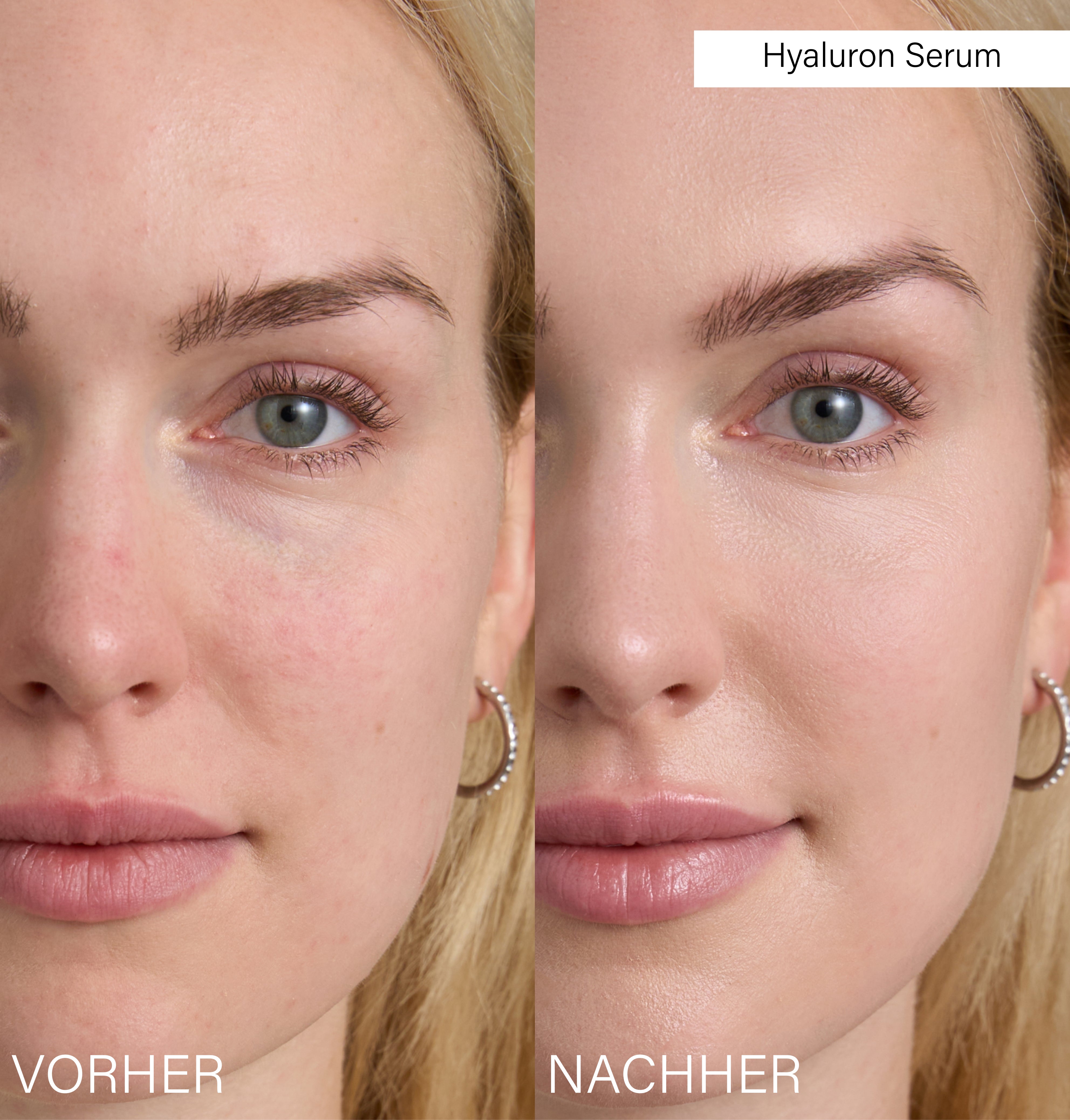 Beauty Bag + Bestseller Serum Set