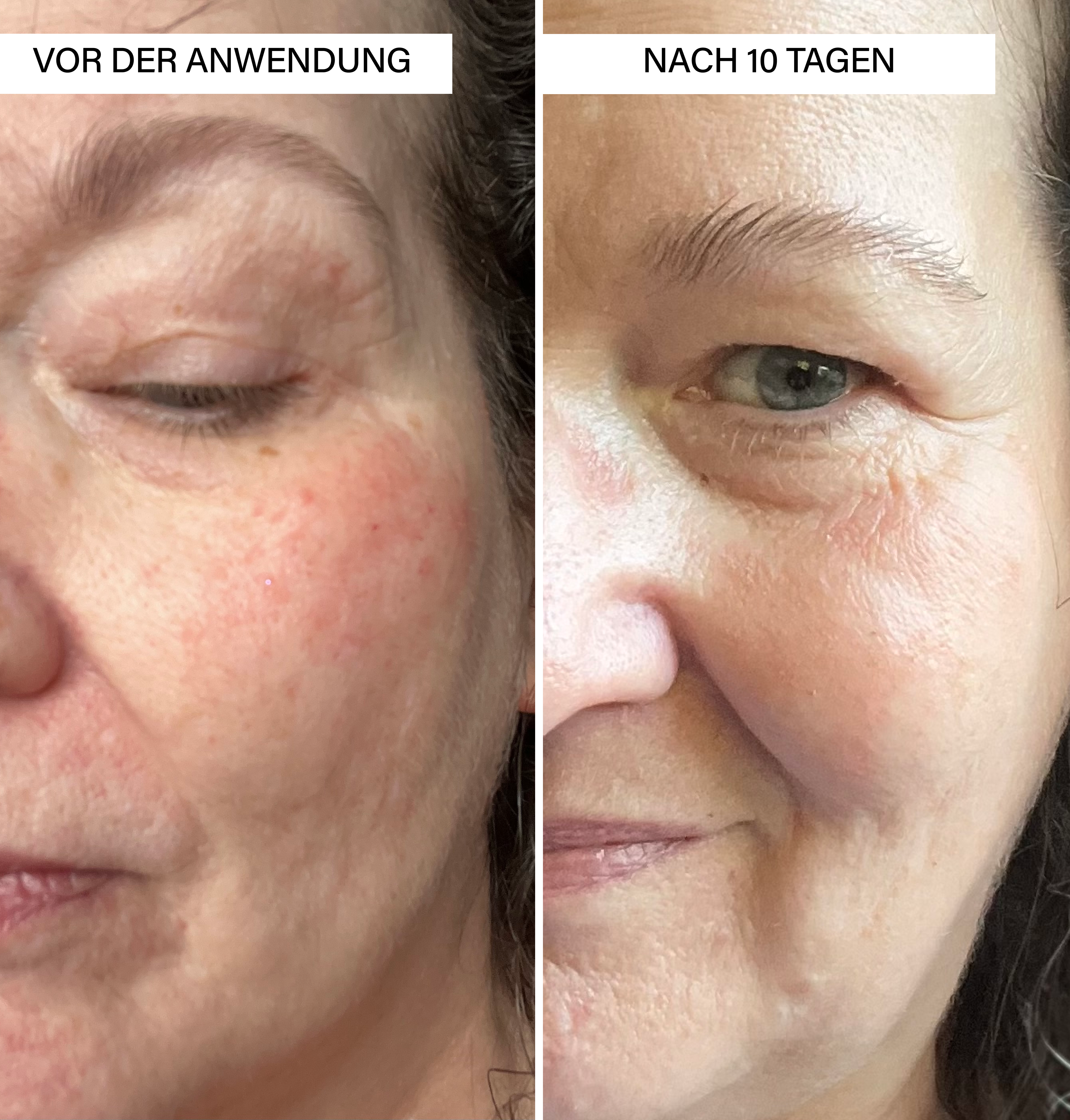 Brightening Serum