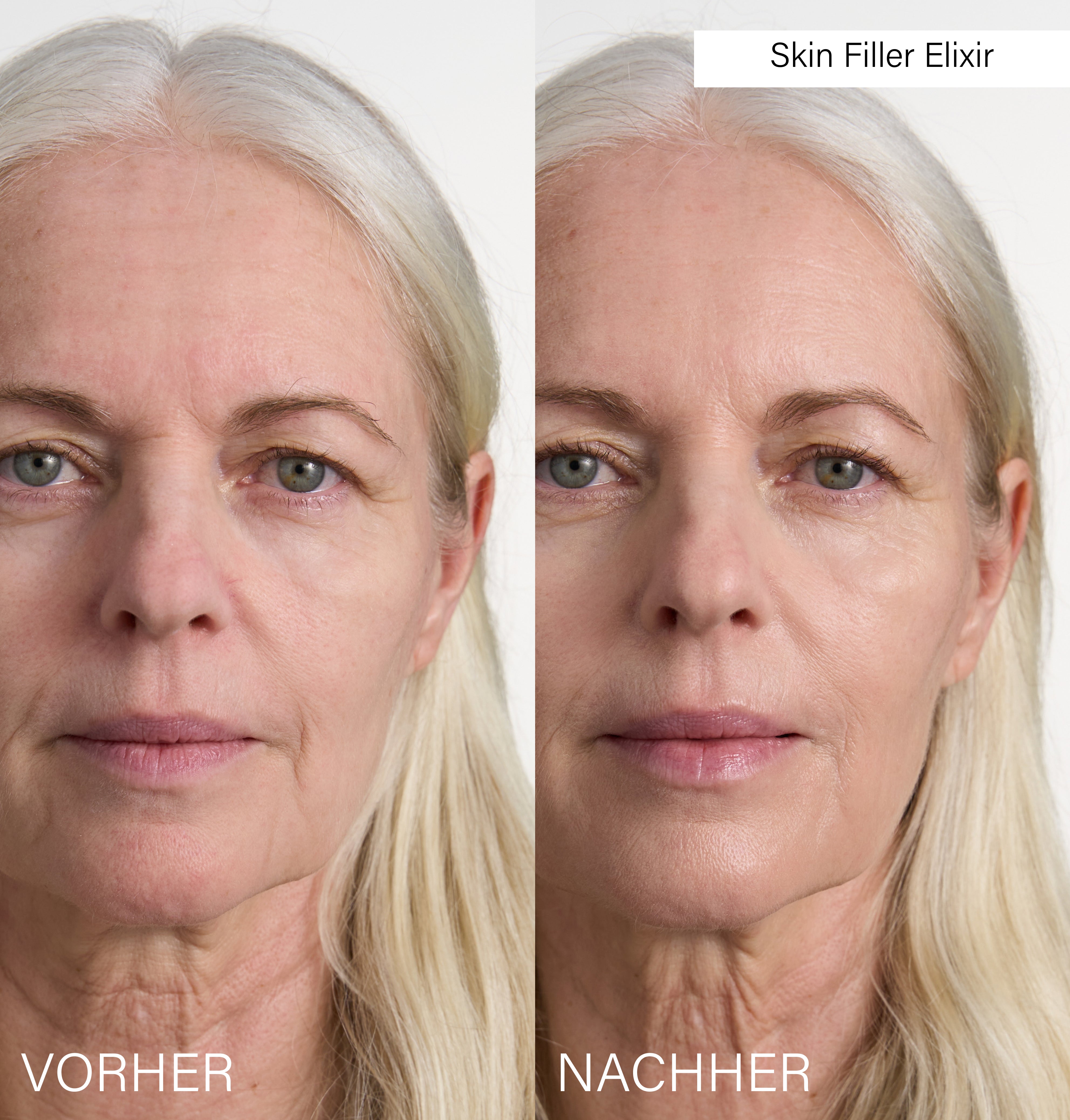 Skin Filler Elixir | Instant lifting & hydration