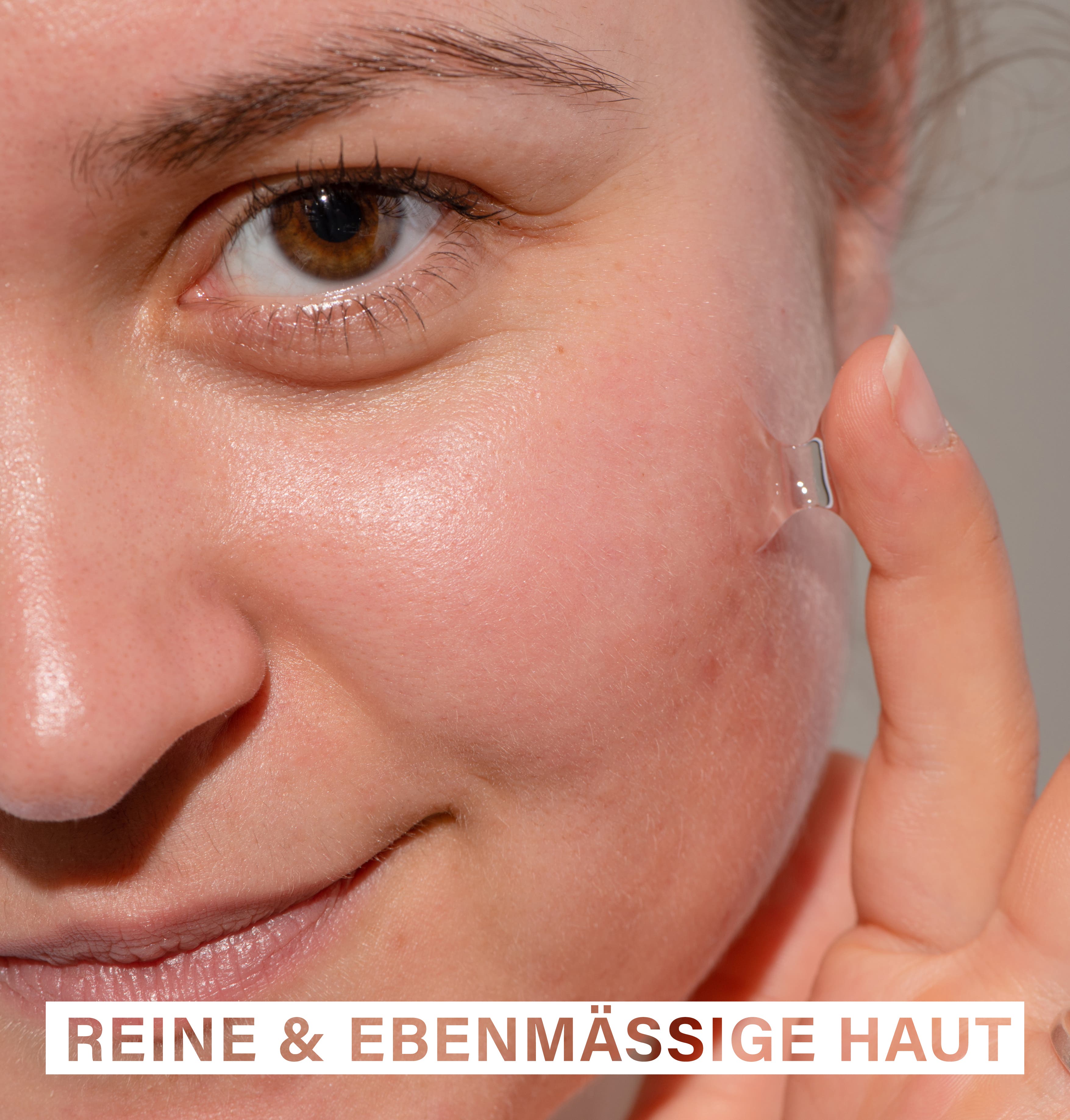 Anti-Breakout Serum | with Zinc, Tea Tree Oil & Probiotics