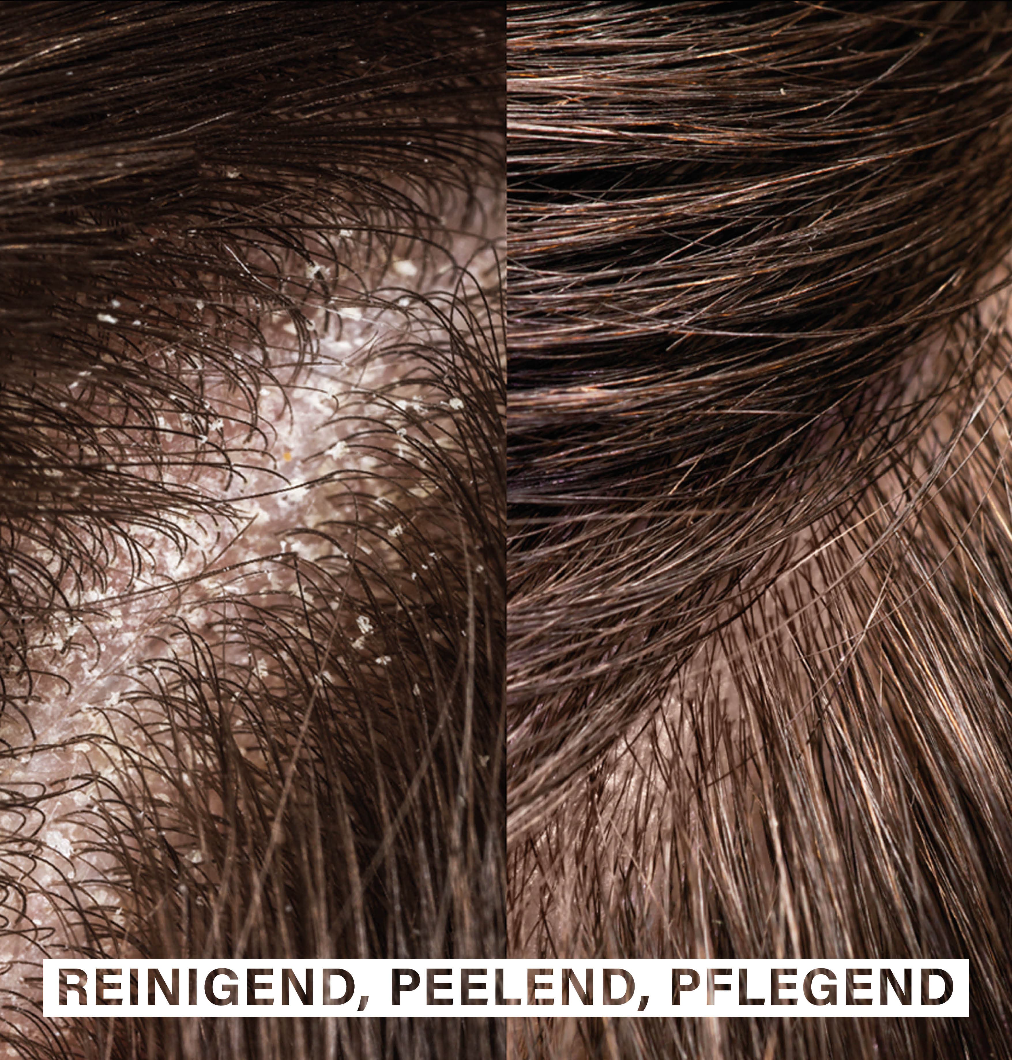 Scalp Exfoliating Shampoo | with papaya extract