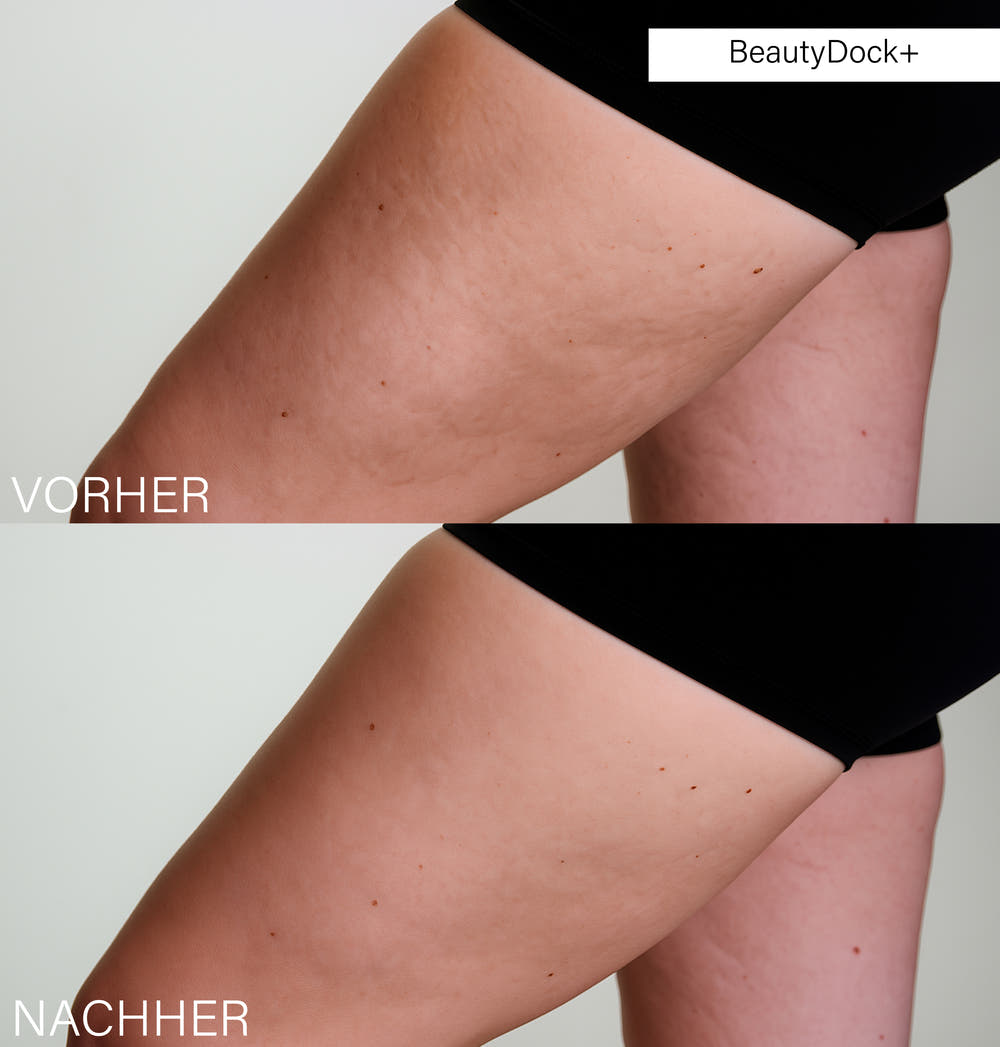 BeautyDock+™ Routine