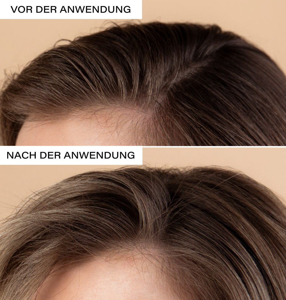 Natural Dry Shampoo | Refreshing and volumizing