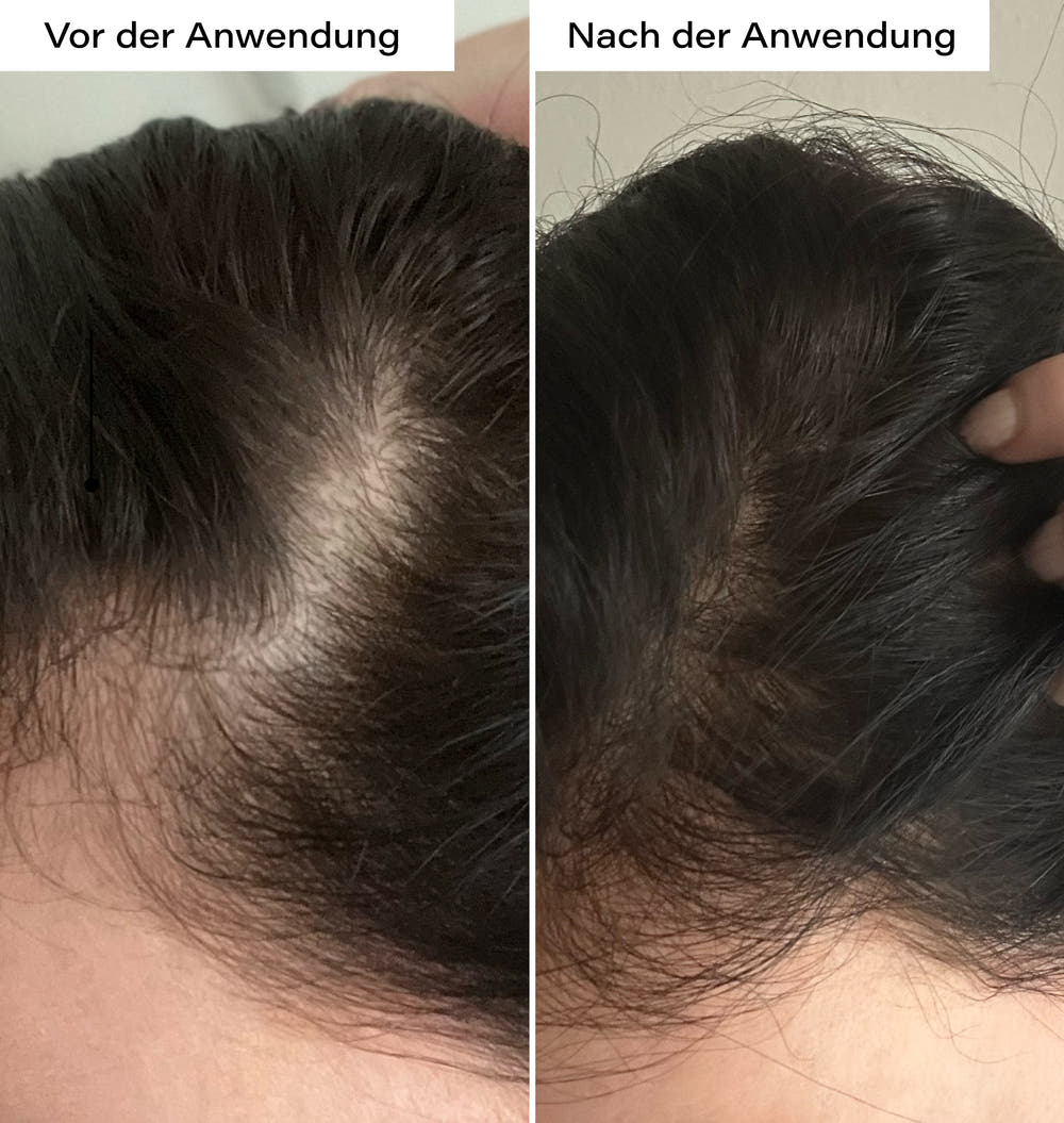 Hair Growth Boost Set