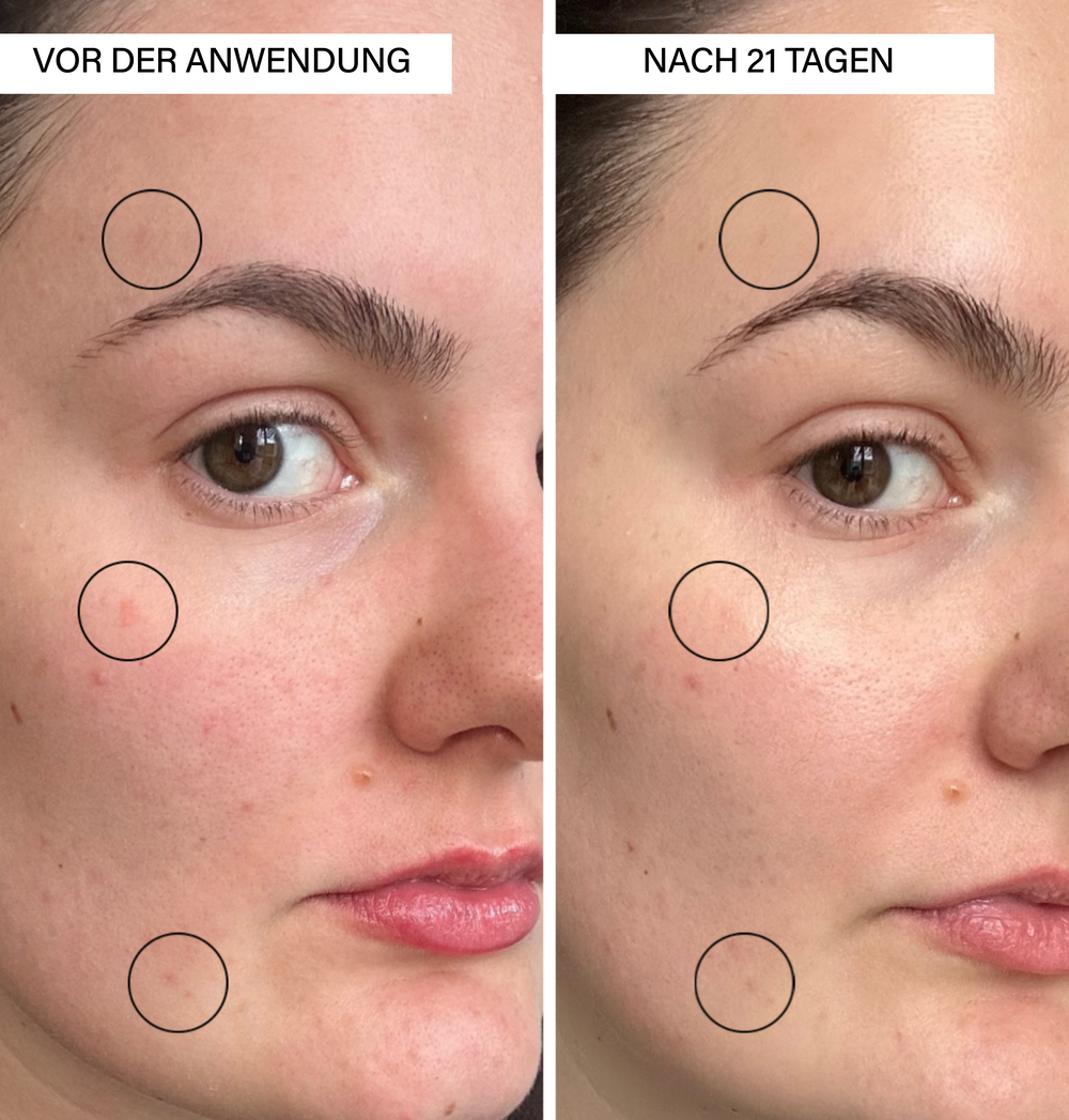 Brightening Serum | with Vitamin C &amp; Botanics