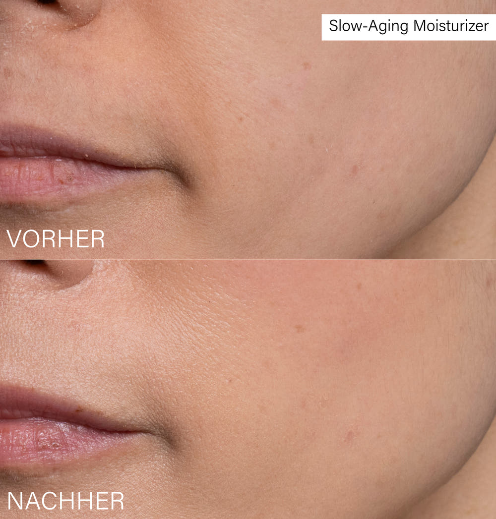 Slow-Aging Moisturizer