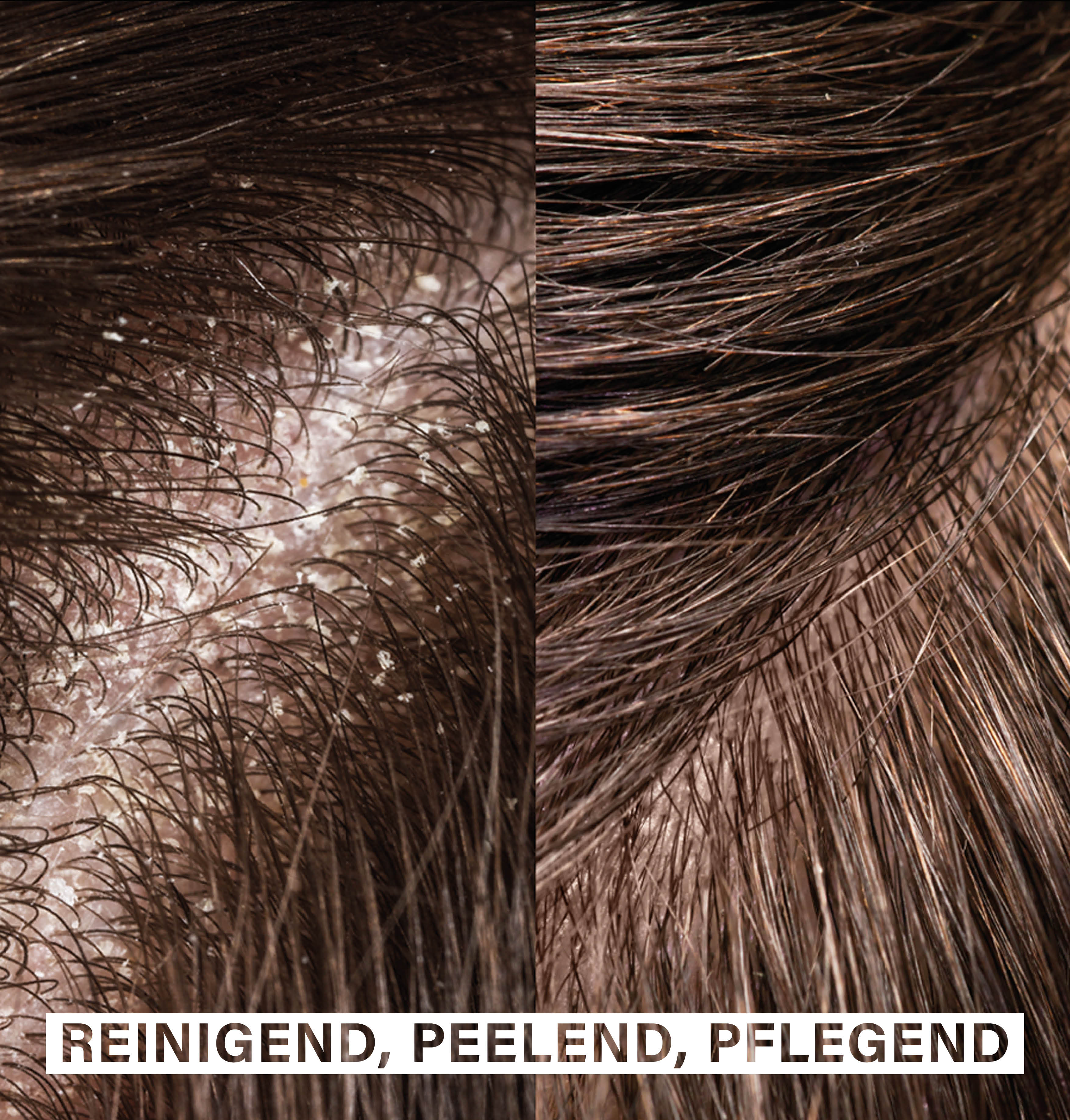 Scalp Exfoliating Shampoo